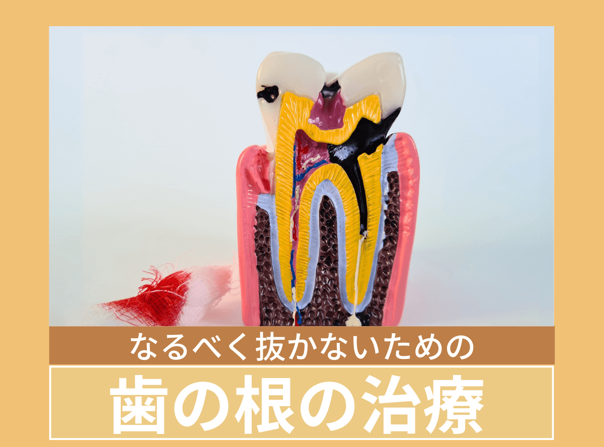 根管治療のリンク
