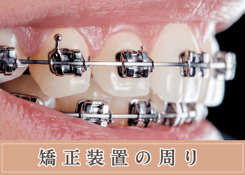 矯正装置の周り画像