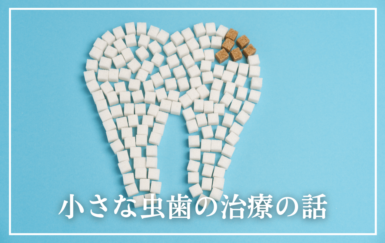 小さな虫歯の治療の話