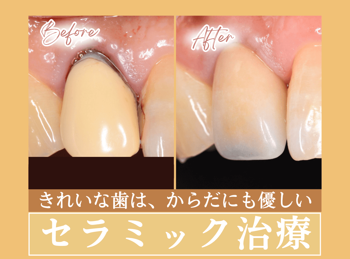 審美歯科のリンク