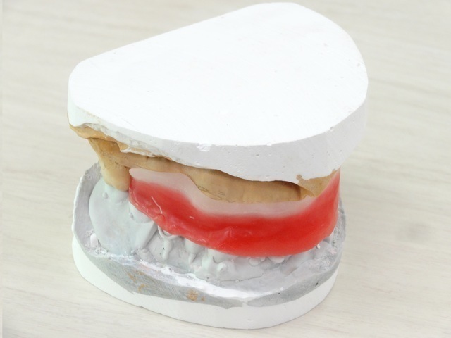 かみ合わせの型取り（バイト）