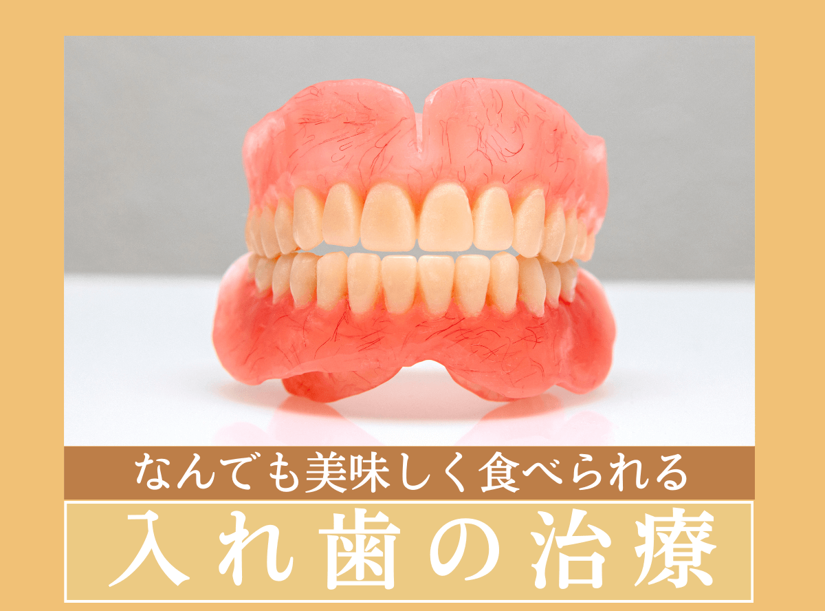 入れ歯治療のリンク