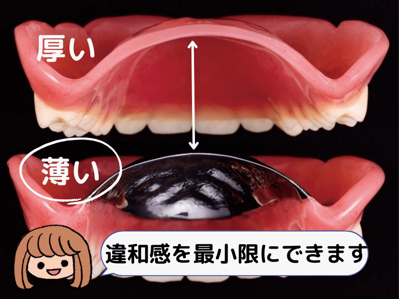 プラスチックの入れ歯と金属の入れ歯の比較