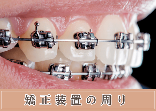 矯正装置の周り画像