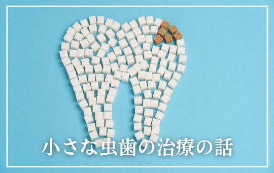小さな虫歯の治療の話