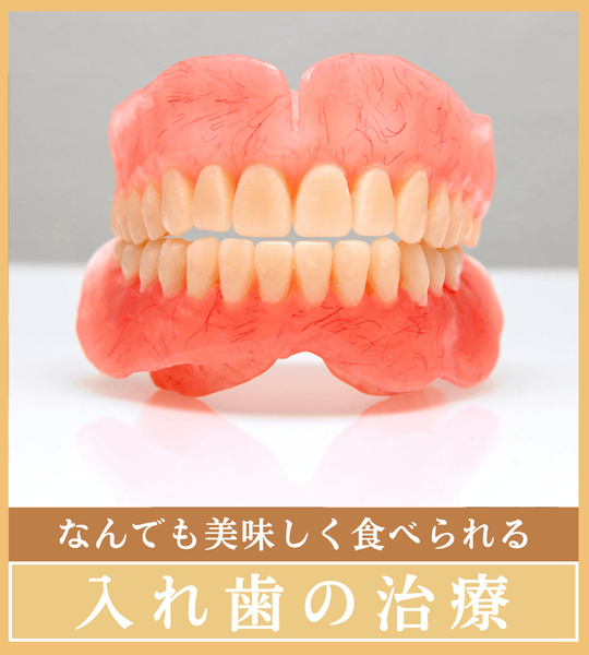 入れ歯の治療