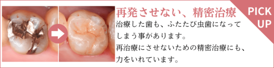 高円寺PAL歯科医院の再発させない、精密治療