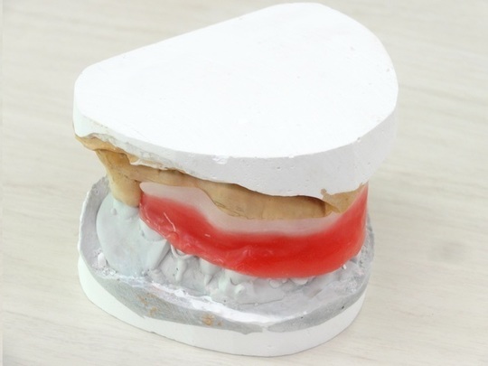 かみ合わせの型取り（バイト）