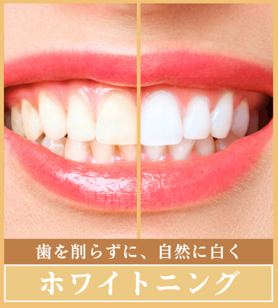 ホワイトニング