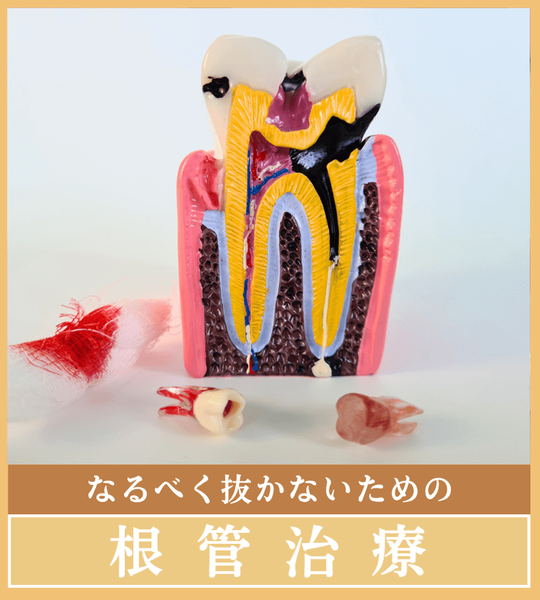 根管治療