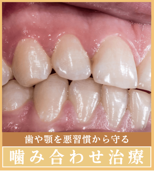 噛み合わせ
