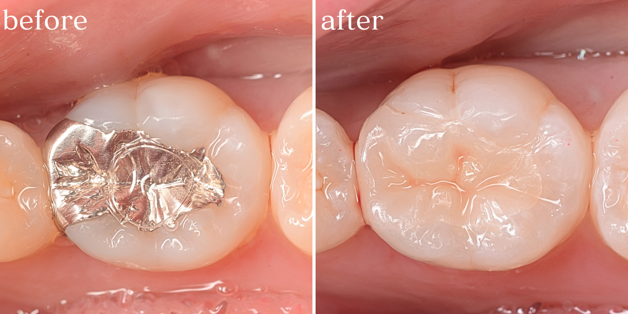 高円寺駅南口徒歩2分の歯医者、高円寺PAL歯科医院