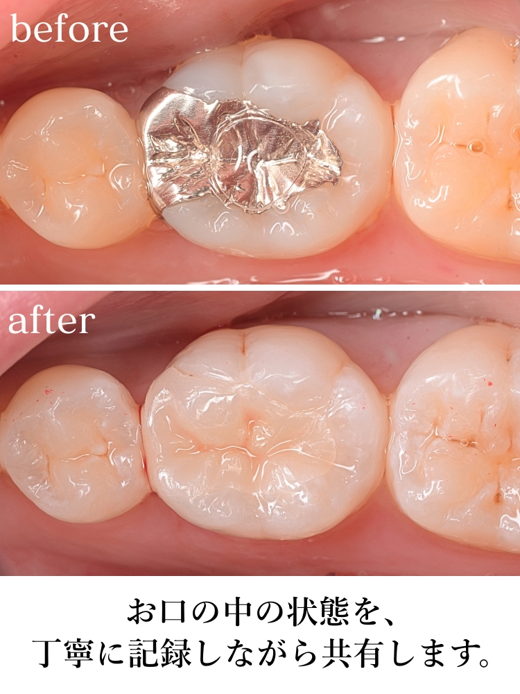 高円寺駅南口徒歩2分の歯医者、高円寺PAL歯科医院