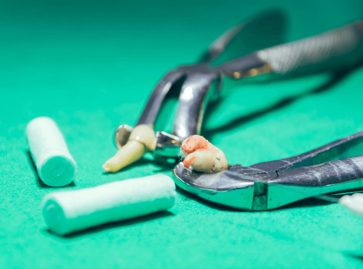 高円寺駅南口徒歩2分の歯医者、高円寺PAL歯科医院の口腔外科