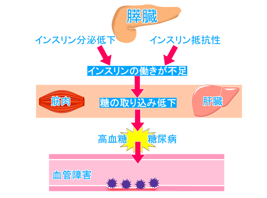 糖尿病