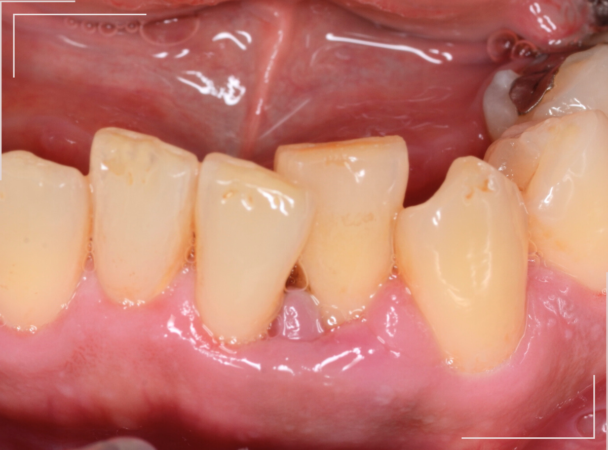 高円寺駅南口徒歩2分の歯医者、高円寺PAL歯科医院の歯科衛生士さんの募集要項