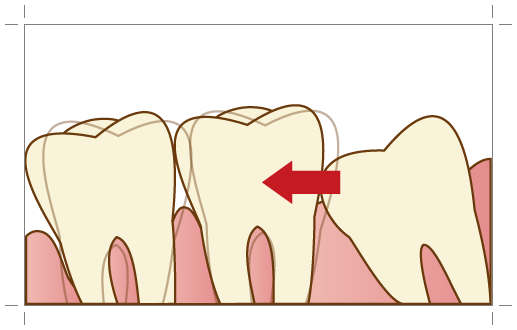高円寺駅南口徒歩2分の歯医者、高円寺PAL歯科医院の口腔外科