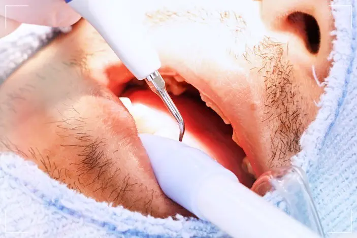 高円寺駅南口徒歩2分の歯医者、高円寺PAL歯科医院の歯科衛生士さんの募集要項