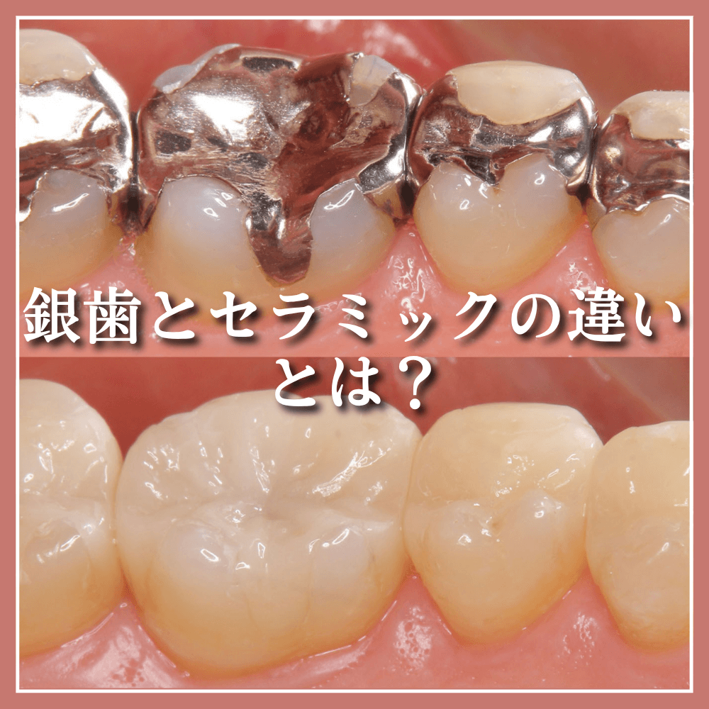 さ*さ様 銀歯 3.png